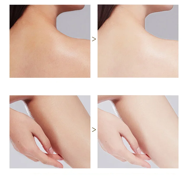 ExfoliatingGel 1+1 GRATIS: Orange Exfolierande Gel Mild Död Hud Borttagare