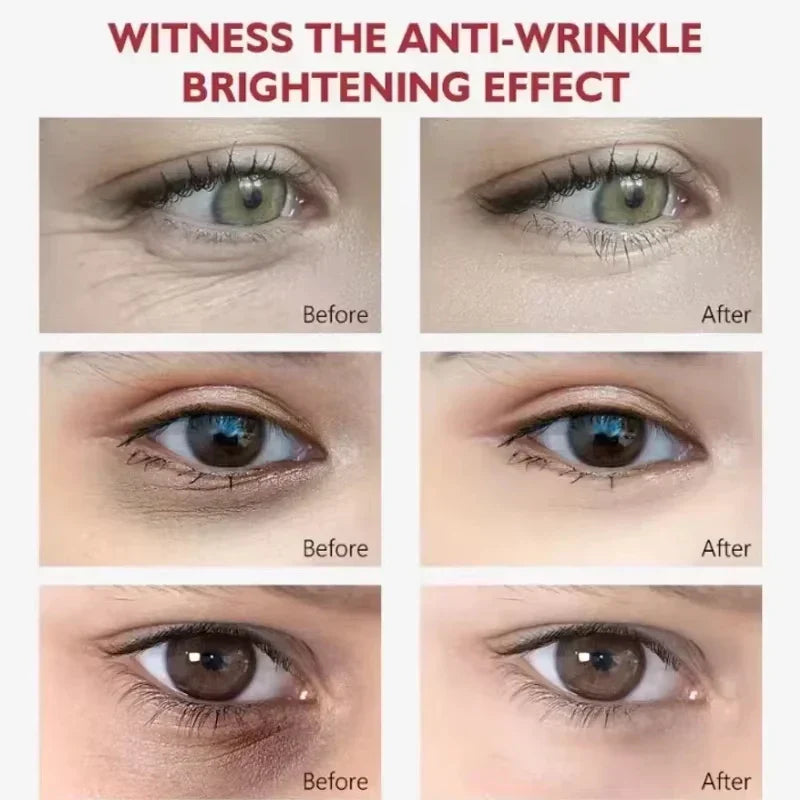 EyeCream 1+1 GRATIS: Hydraterande Uppstramande Anti Mörk Cirklar Öga Grädde Serum