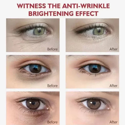 EyeCream 1+1 GRATIS: Hydraterande Uppstramande Anti Mörk Cirklar Öga Grädde Serum