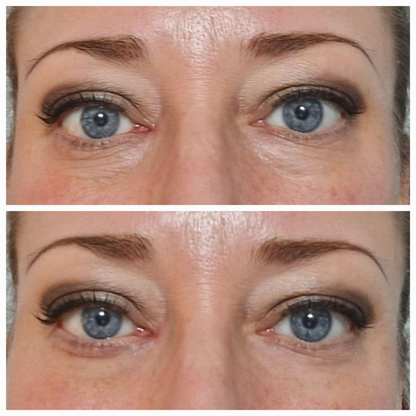 EyeCream 1+1 GRATIS: Hydraterande Uppstramande Anti Mörk Cirklar Öga Grädde Serum