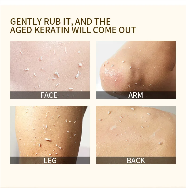 ExfoliatingGel 1+1 GRATIS: Orange Exfolierande Gel Mild Död Hud Borttagare